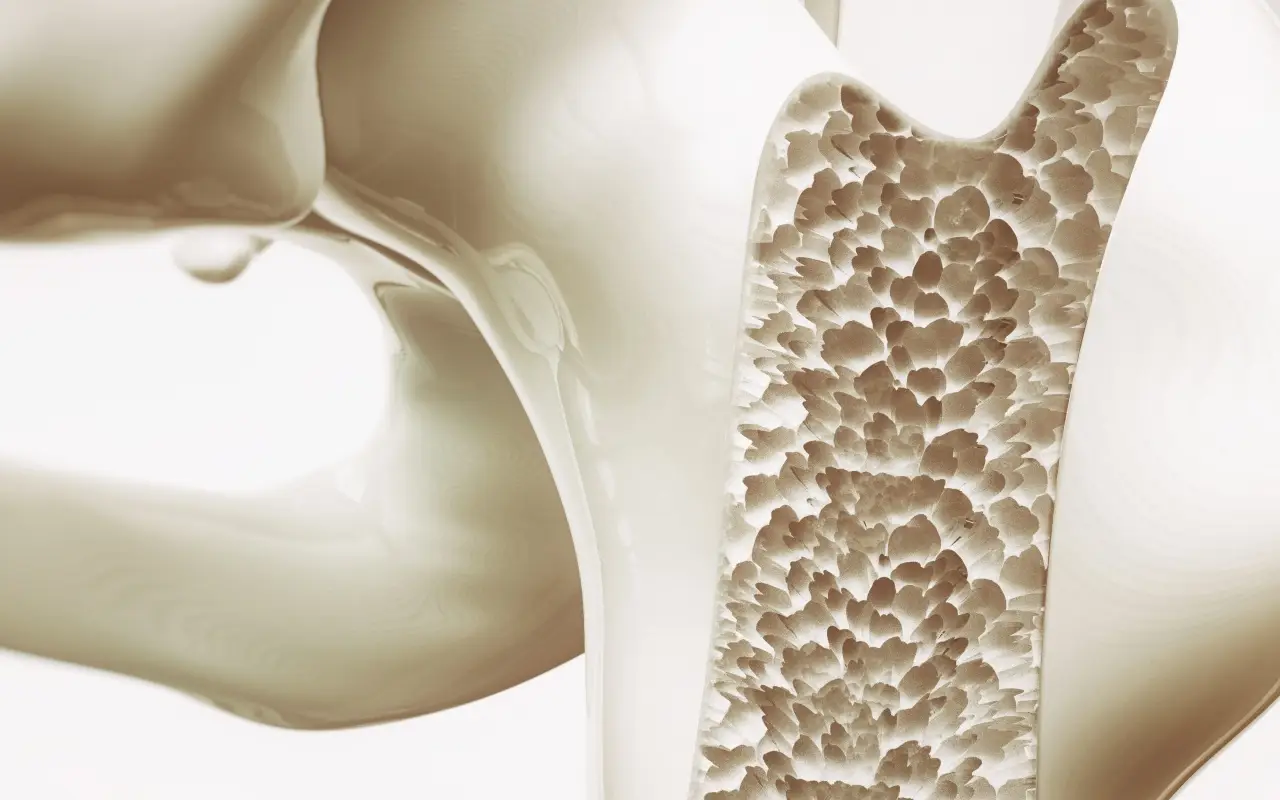 Jauns atklājums kaulu stiprināšanā var apturēt osteoporozi