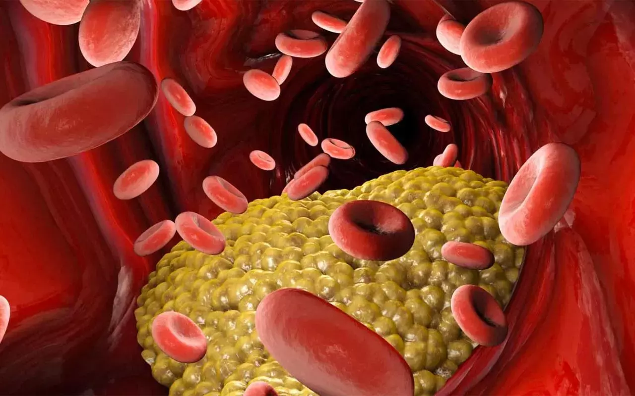 Cianīda saindēšanās: Medicīnas pakalpojumu departaments iesaka pirmās palīdzības sniegšanas metodes, uzsverot, ka, ja cianīds ir nokļuvis mutē, nedrīkst izraisīt vemšanu.