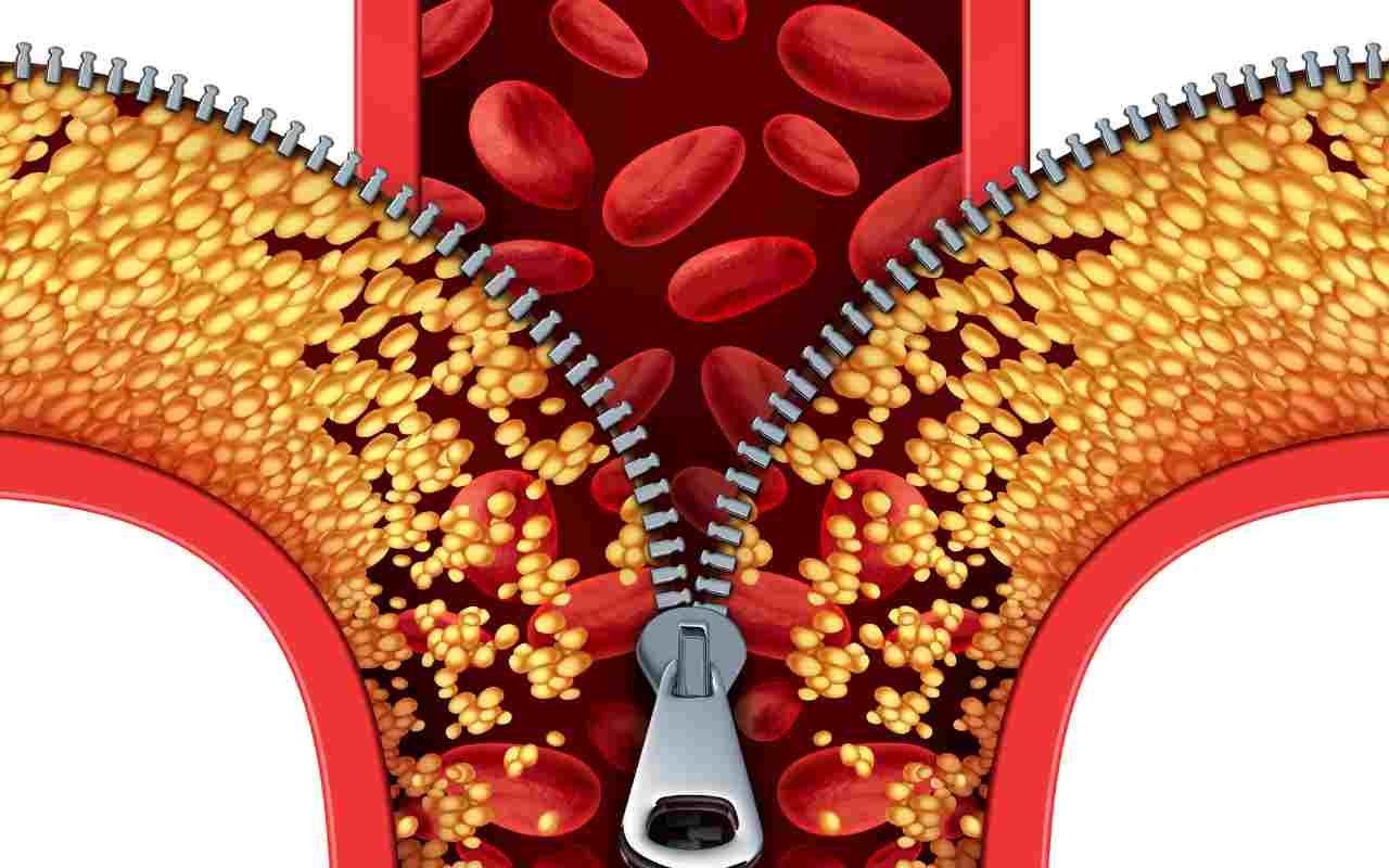 Holesterīns: rutīna, kas to “paaugstina” — kas jāizvairās