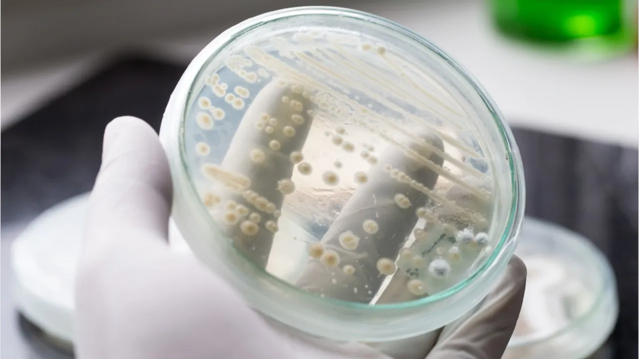 Zinātnieki ir atraduši iespējamo veidu, kā cīnīties ar sēnīti, kas skar pacientus slimnīcās.