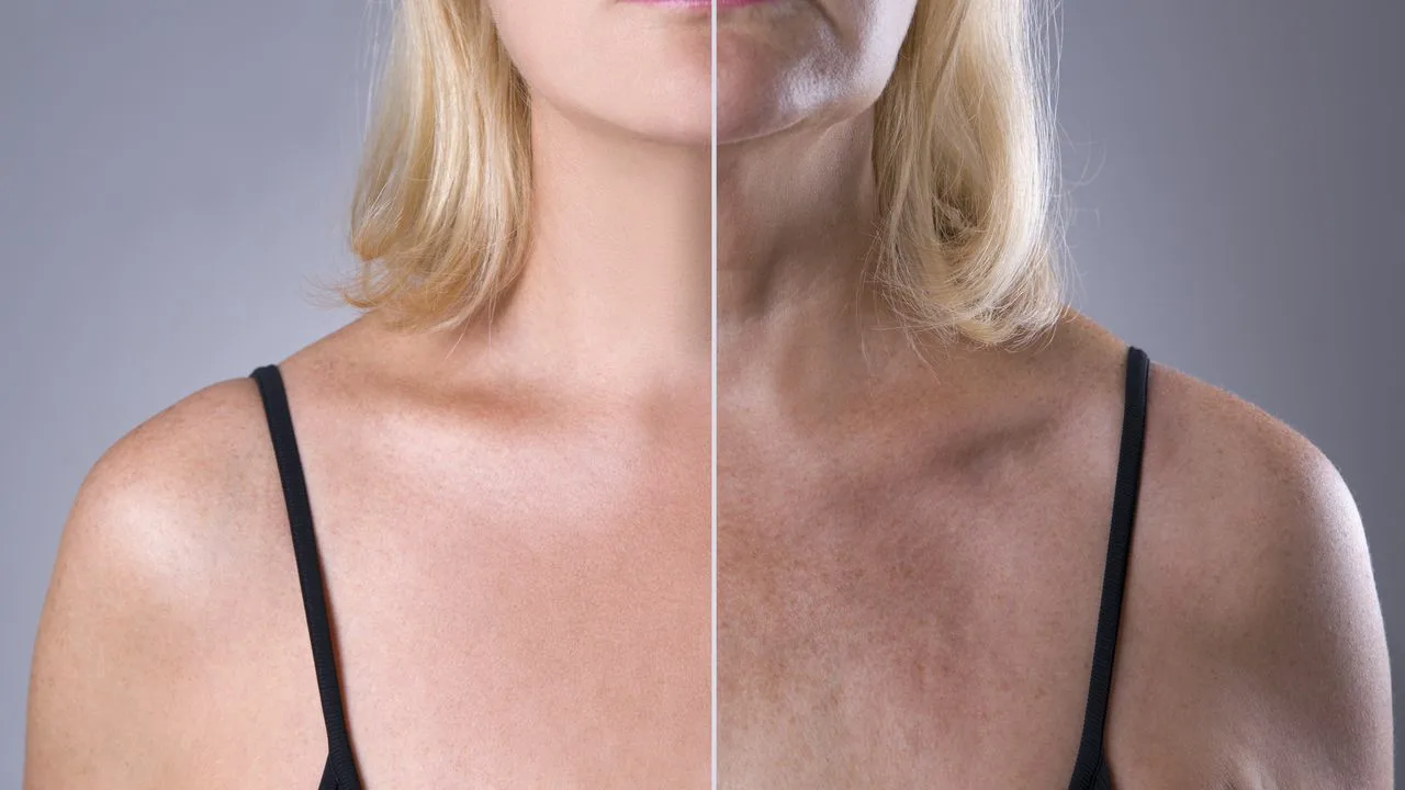 Kā ātri izlīdzināt grumbu uz kakla un atjaunot ādas elastību mājās