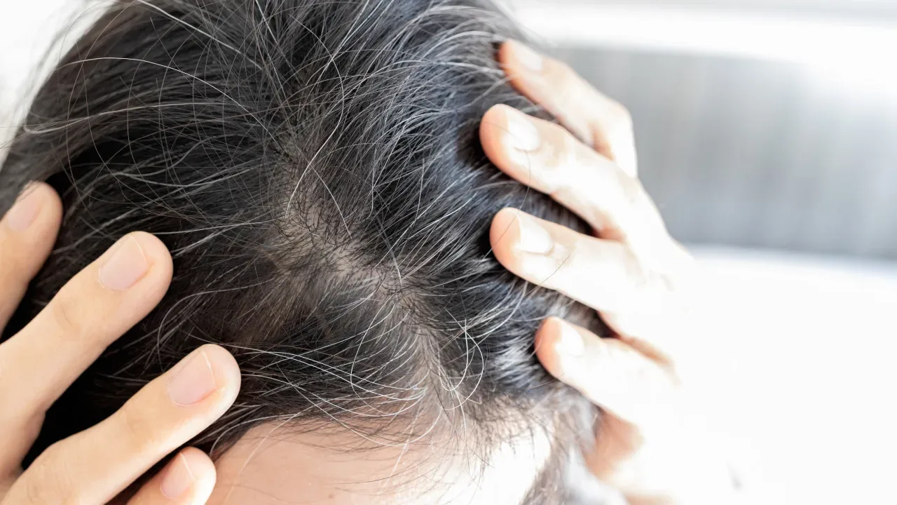 Pārtikas sodas un rozmarīna izmantošana sirmu matu apstrādei: kāpēc tas ir nepieciešams un kā to darīt.