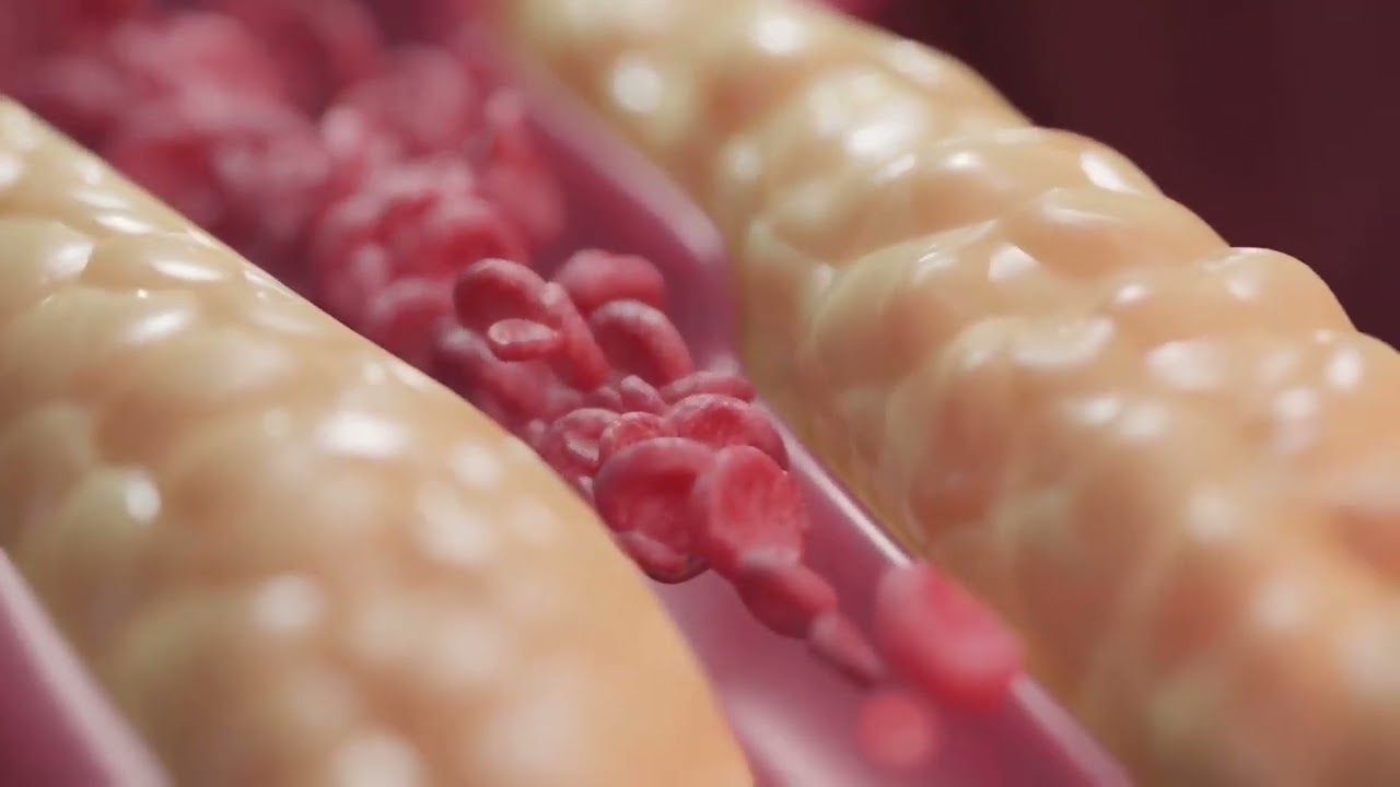 Zinātnieki ir iemācījušies kontrolēt holesterīna aktivitāti ar gaismas palīdzību