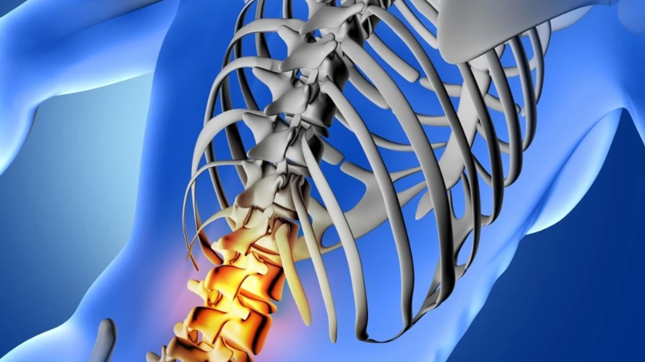 Degeneratīvās mugurkaula slimības: kā tās atpazīt un kad jārīkojas.