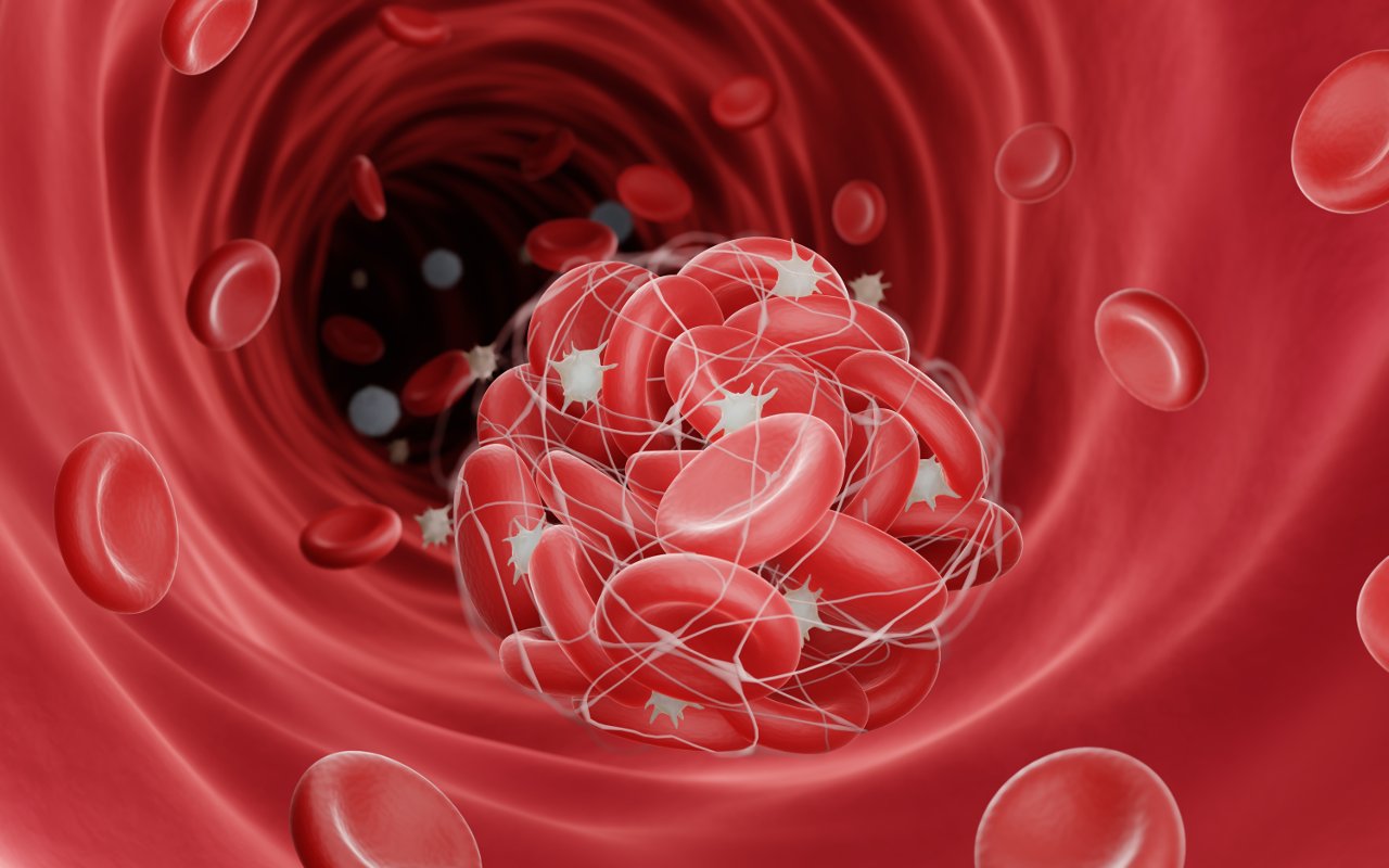 Novērš trombozi. Šis unikālais dārzenis samazina holesterīna un triglicerīdu līmeni asinīs.