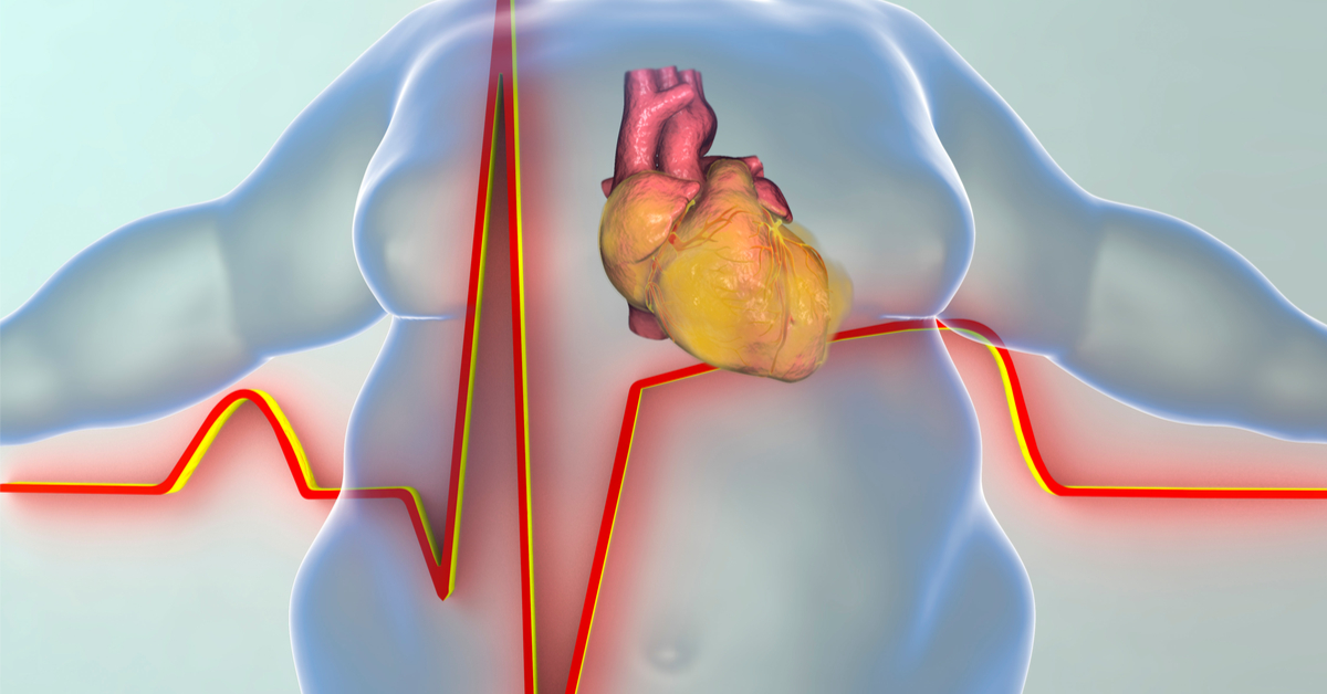 Semaglutīds. Latvijas tirgū parādījies pirmais injicējams preparāts aptaukošanās ārstēšanai.
