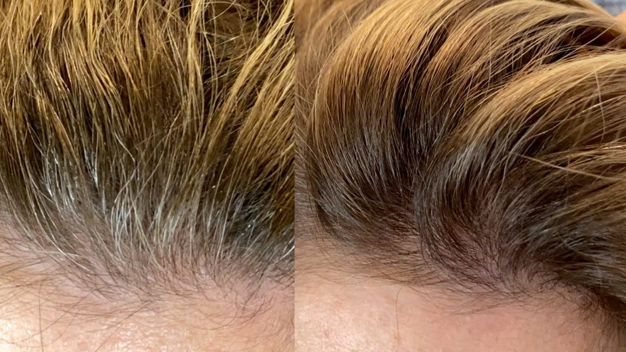 Šampūns, kas nokrāso sirmu matu, nekrāsojot matus.