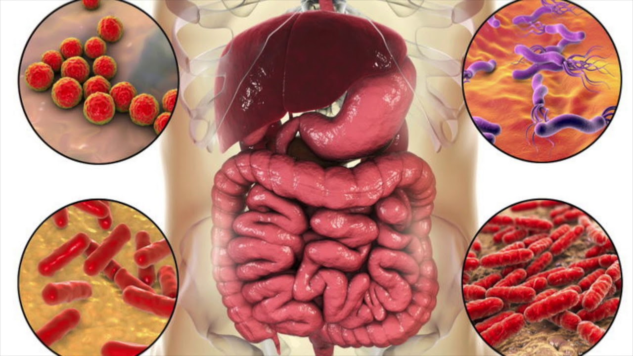 Tauku audi pie resnās zarnas var ietekmēt zarnu imūno reakciju.