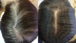 Šampūns, kas nokrāso sirmu matu, nekrāsojot matus.